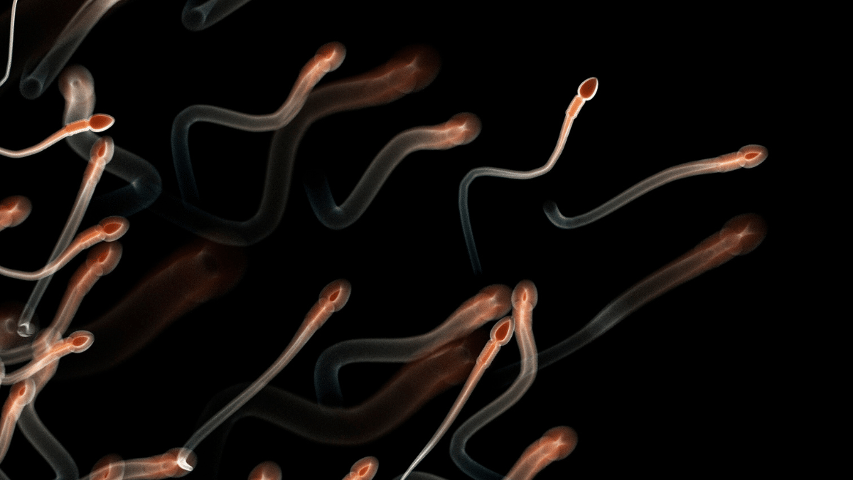 retrograde ejaculation causes