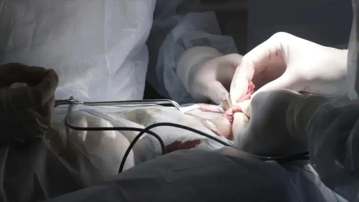 How Can I Get Hard After Prostatectomy