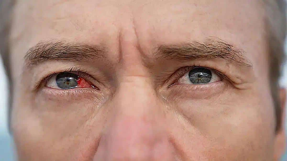 Exploring the Various Types of Eye Infections: A Comprehensive Guide