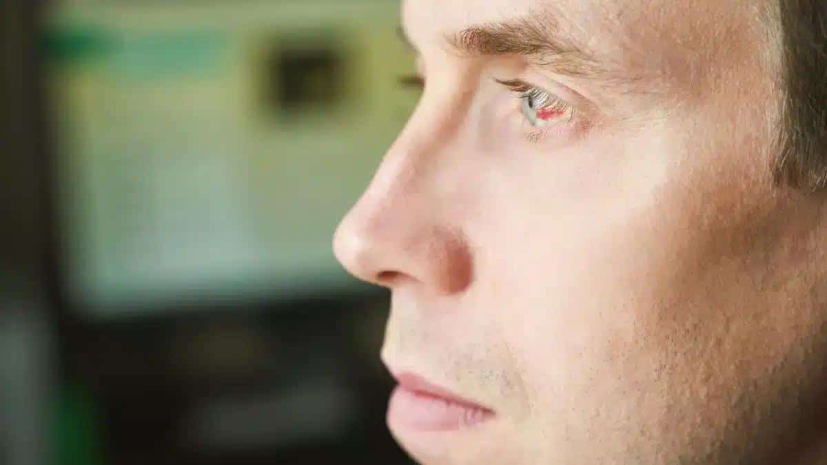 Exploring Uveitis Causes: From Infections to Autoimmune Factors 