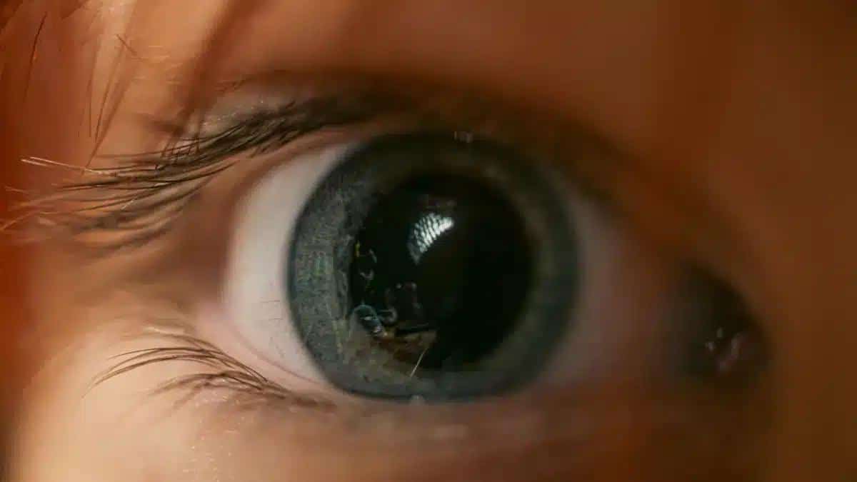 From Causes to Treatment Options: What is Stromal Keratitis?