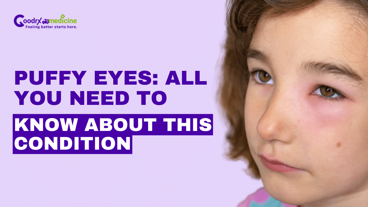 Puffy Eyes: All You Need to Know About this Condition