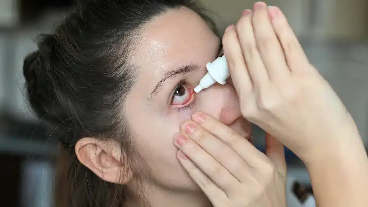 eye-drops-for-watery-eyes