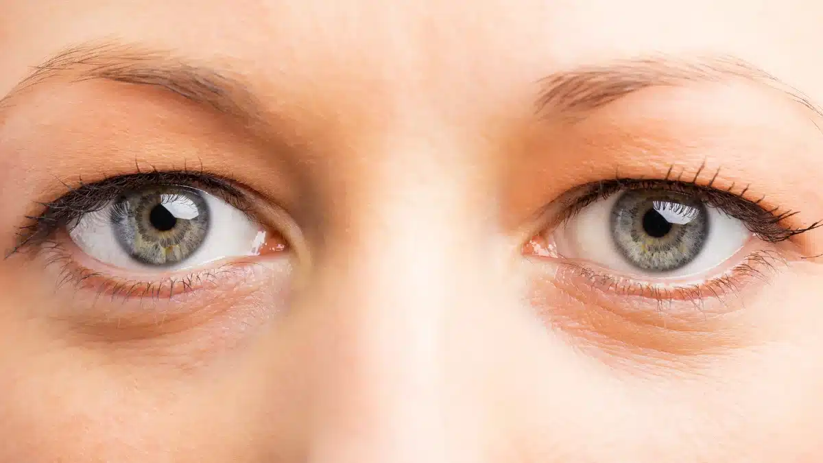 eye twitching remedy