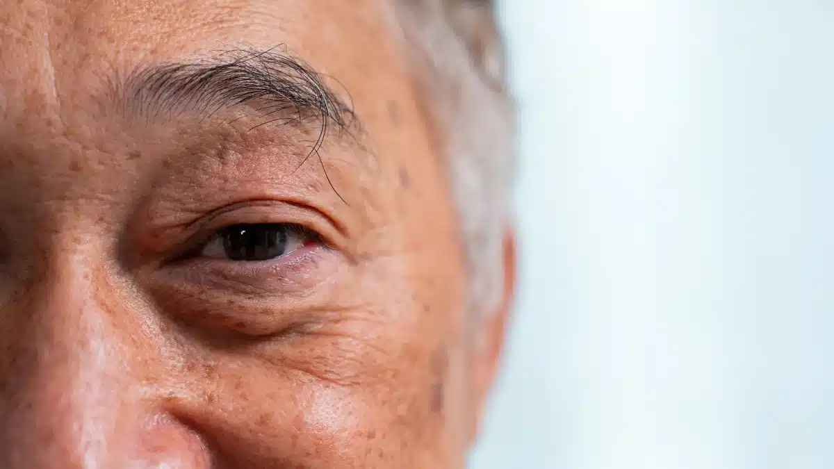 cataract symptoms
