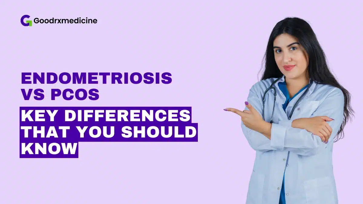 Endometriosis vs PCOS