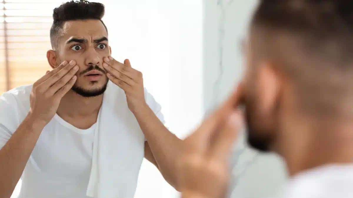 Low Testosterone Face: Understanding the Impact of Low Testosterone on Facial Features
