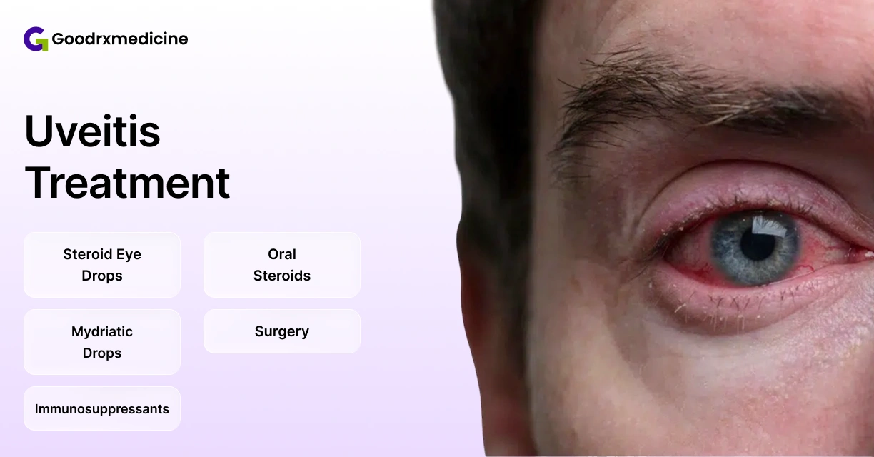 6 Best Uveitis Medications for Best Results