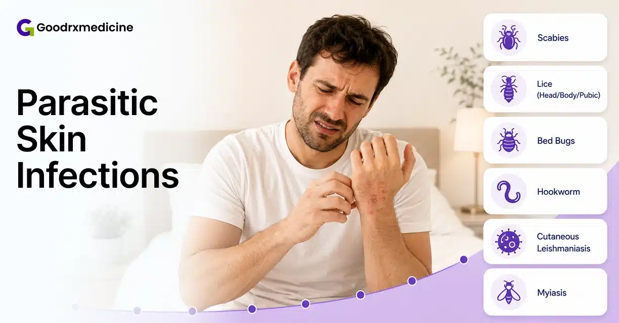 Man scratching an irritated wrist with examples of parasitic skin infections