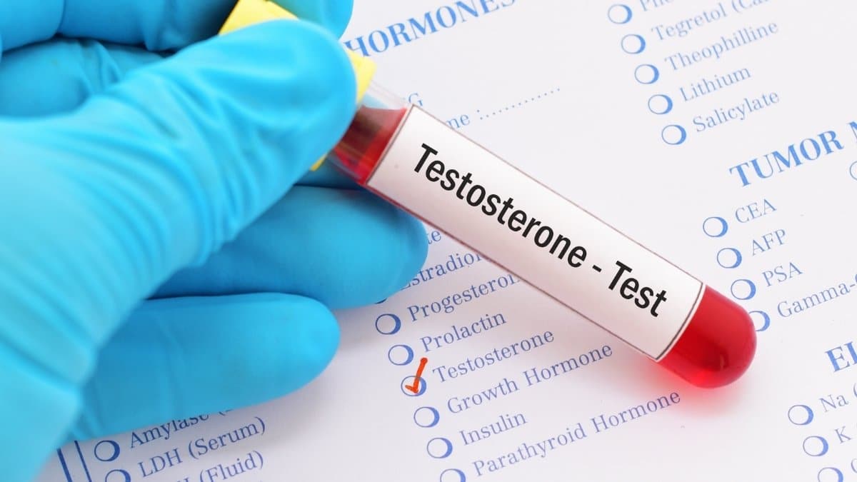 Testing testosterone level in men