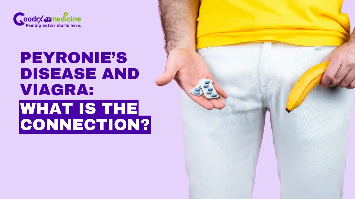 Peyronie’s Disease and Viagra