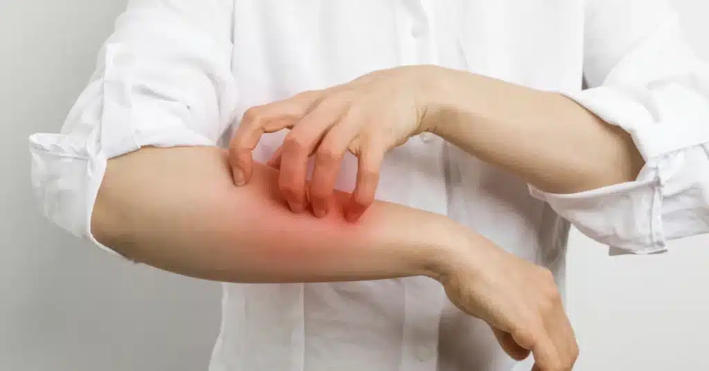 itching forearm