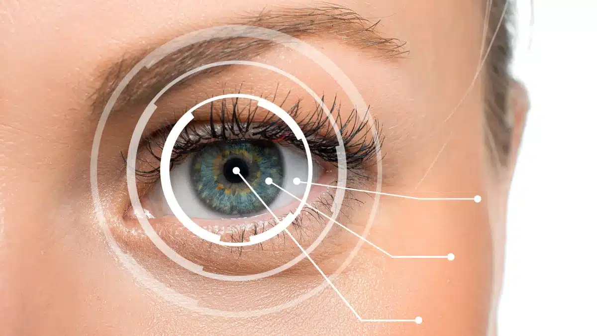 secondary cataract