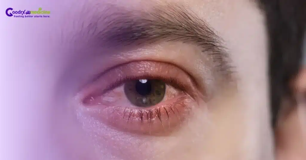 Eye Problem as a side effect