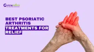 Best Psoriatic Arthritis Treatments for Relief