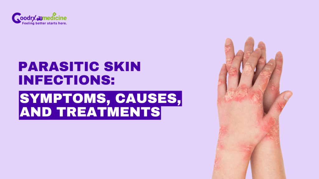 Parasitic Skin Infections: Symptoms, Causes, and Treatments