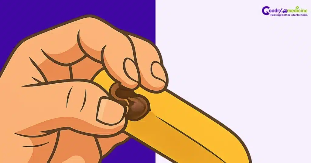 squeeze technique