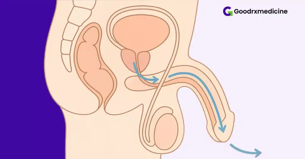 Side-view illustration showing correct outward semen flow