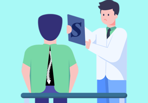 Scoliosis Treatment